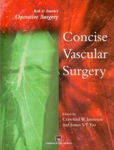 medical/cardiac-surgery/rob-smith-s-operative-surgery-concise-vascular-surgery-excl-abc--9780412824500