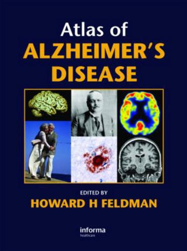 medical/neurology/atlas-of-alzheimer-s-disease-9780415390453