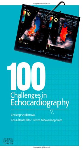 medical/cardiology/100-challenges-in-echocardiography-9780443069277