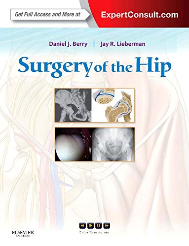 medical/orthopaedics/surgery-of-the-hip-expert-consult---online-and-print-9780443069918