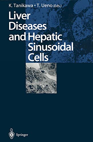 medical/gastroenterology/liver-diseases-and-hepatic-sinusoidal-cells-9784431702375