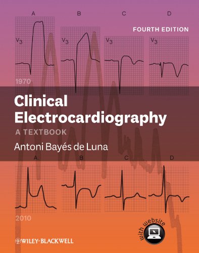 medical/cardiology/clinical-electrocardiography-a-textbook-9780470658598