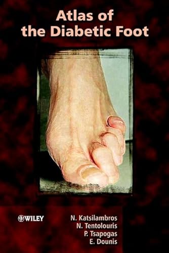 technical/general/atlas-of-the-diabetic-foot-9780471486732