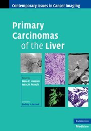 medical/gastroenterology/hussain-primary-carcinomas-of-the-liver-9780521519519