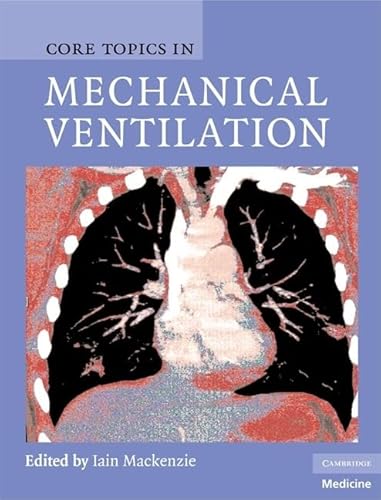 technical/general/core-topics-in-mechanical-ventilation-9780521867818