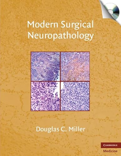 medical/pathology/modern-surgical-neuropathology-with-cd-rom-9780521869324