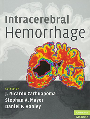 medical/neurology/carhuapoma-intracerebral-hemorrhage-9780521873314