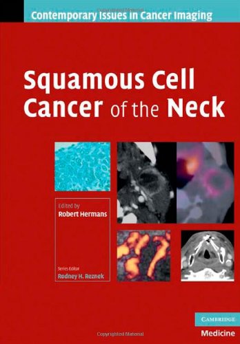 medical/oncology/squamous-cell-cancer-of-the-neck-9780521886918