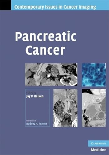 medical/oncology/heiken-pancreatic-cancer-9780521886925