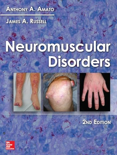medical/neurology/neuromuscular-disorders-9780071752503