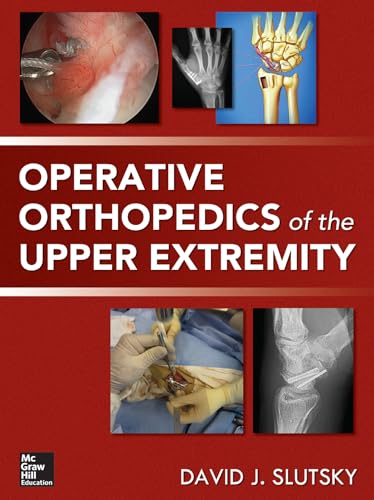 medical/orthopaedics/operative-orthopedics-of-the-upper-extremity-9780071789271
