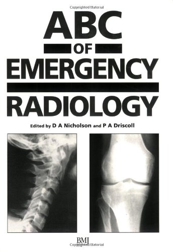 ABC OF EMERGENCY RADIOLOGY medical/radiology/abc-of-emergency-radiology-9780727908322