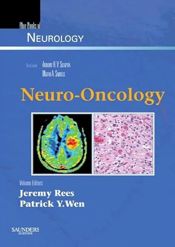 medical/neurology/neuro-oncology-blue-books-of-neurology-series-9780750675161