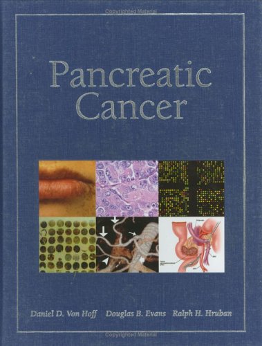 medical/oncology/pancreatic-cancer-cb-9780763721787