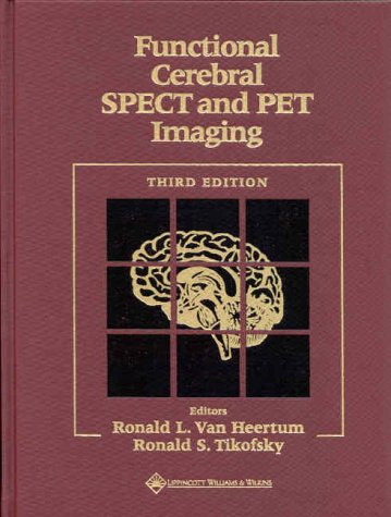 medical/radiology/functional-cerebral-spect-and-pet-imaging-9780781718707
