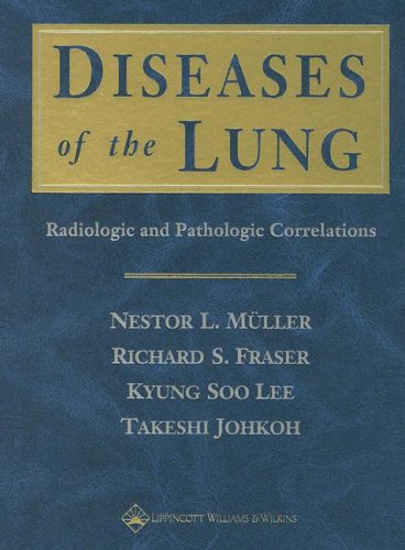 medical/respiratory-medicine/diseases-of-the-lung-9780781734356