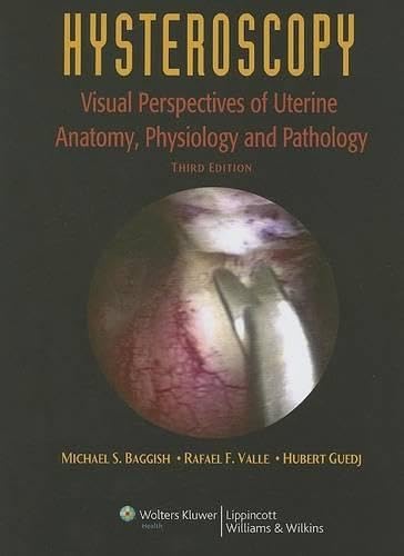technical/general/hysteroscopy-visual-perspectives-of-uterine-anatomy-physiology-patholo-9780781755320