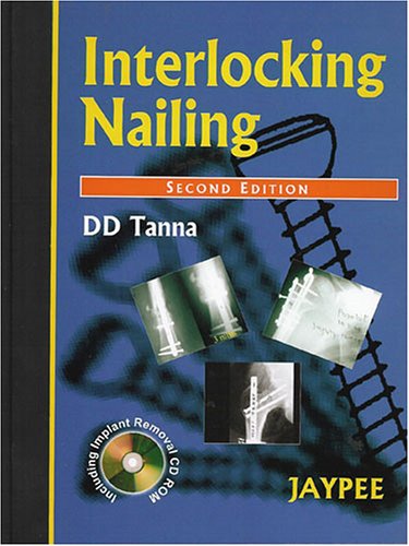 medical/surgery/interlocking-nailing-2ed-with-cd-9788180612275