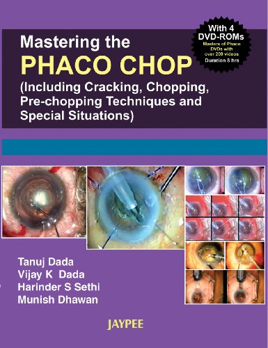 medical/ophthalmology/mastering-the-nucleotomy-techniques-in-phaco-with-4-dvd-roms-9788180619014