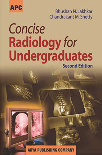 medical/cardiac-surgery/concise-radiology-for-undergraduates-2-ed-9788182964785