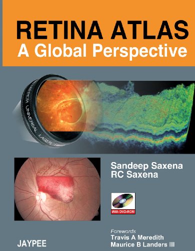 medical/ophthalmology/retina-atlas-a-global-perspective-with-dvd-rom-9788184482195