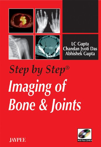 STEP BY STEP IMAGING OF BONE & JOINTS WITH PHOTO CD-ROM, 1/ED medical/radiology/step-by-step-imaging-of-bone-joints-with-photo-cd-rom-1-ed-9788184483697