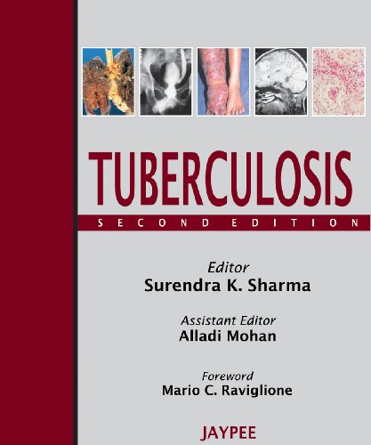 medical/respiratory-medicine/tuberculosis-9788184485141