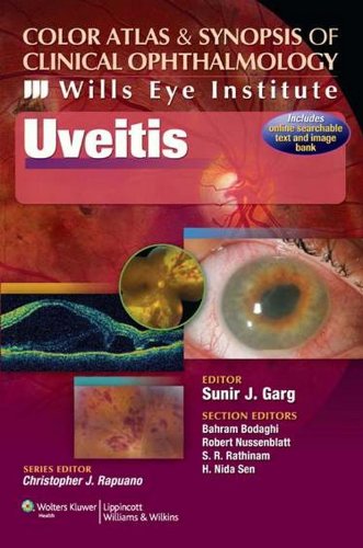 COLOR ATLAS & SYNOPSIS OF CLINICAL OPHTHALMOLOGY - UVEITIS , 1/ED