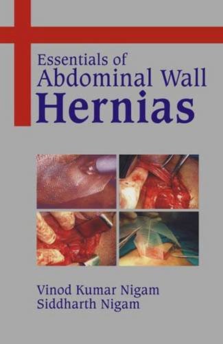 ESSENTIALS OF ABDOMINAL WALL HERNIAS WITH CD-ROM
