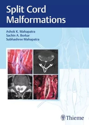 exclusive/neurology/split-cord-malformations-9788194857099