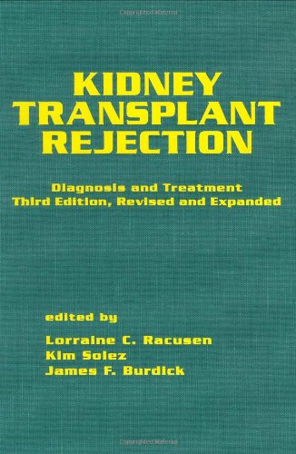 medical/nephrology/kidney-transplant-rejection-3-ed-9780824701390