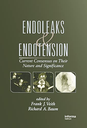technical/general/endoleaks-endotension-current-consensus-on-their-nature-and-significance-9780824709549