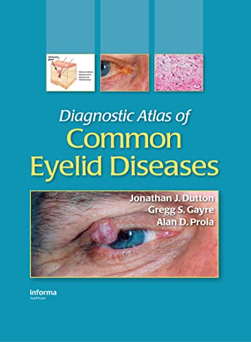 medical/ophthalmology/diagnostic-atlas-of-common-eyelid-diseases-9780824728397