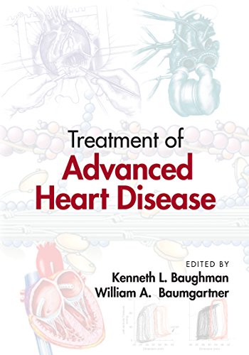TREATMENT OF ADVANCED HEART DISEASE medical/cardiology/treatment-of-advanced-heart-disease-9780849338267