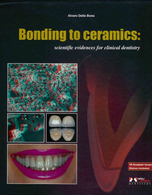 medical/dentistry/bonding-to-ceramics-scientific-evidences-for-clinical-dentistry-9788536700915