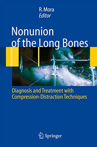 medical/orthopaedics/nonunion-of-the-long-bones-diagnosis-and-treatment-with-compression-distraction-techniques-9788847004085