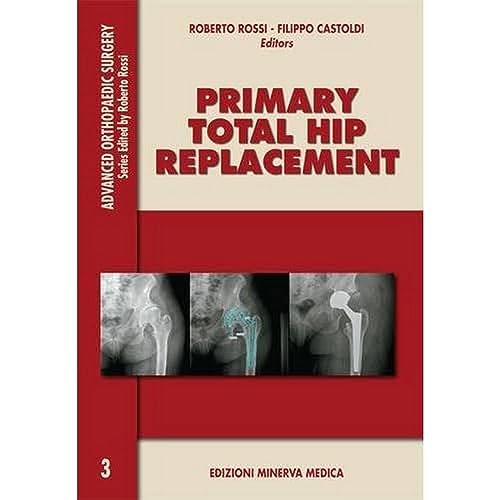 technical/general/primary-total-hip-replacement-9788877117816