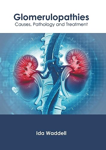 exclusive/nephrology/glomerulopathies-causes-pathology-and-treatment-9798887401362
