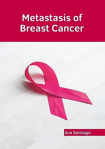 exclusive//metastasis-of-breast-cancer-9798887402635
