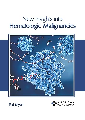 NEW INSIGHTS INTO HEMATOLOGIC MALIGNANCIES
