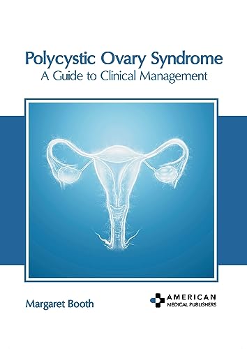 POLYCYSTIC OVARY SYNDROME: A GUIDE TO CLINICAL MANAGEMENT