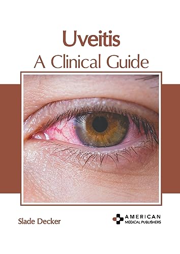 UVEITIS: A CLINICAL GUIDE
