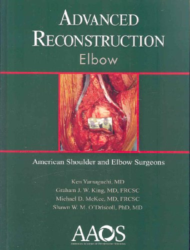 medical/orthopaedics/advanced-reconstruction-elbow-1-ed-9780892033911