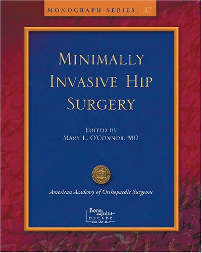 technical/general/limited-incisions-for-total-hip-arthroplasty-1-ed-9780892034246