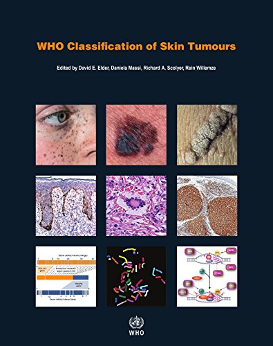 medical/pathology/who-classification-of-skin-tumours-4-ed-9789283224402