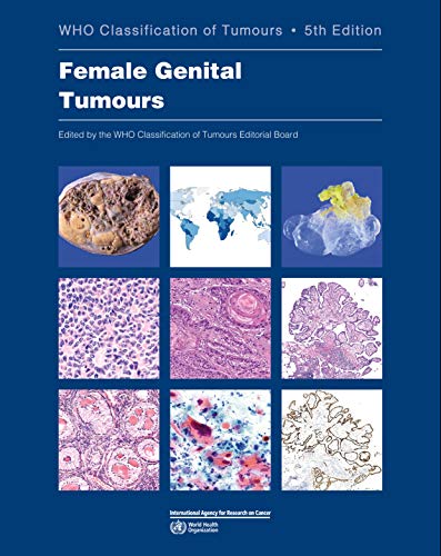 WHO CLASSIFICATION OF FEMALE GENITAL TUMOURS