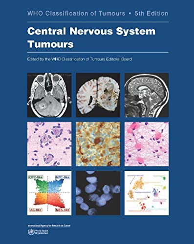 WHO CLASSIFICATION OF TUMOURS OF THE CENTRAL NERVOUS SYSTEM VOL-6