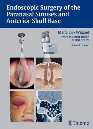medical/otolaryngology/endoscopic-surgery-of-the-paranasal-sinuses-and-anterior-skull-base-9789380378534