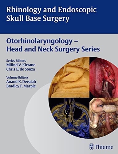 medical/otolaryngology/rhinology-and-endoscopic-skull-base-surgery---otolaryngology---head-and-neck-surgery-series-9789382076018
