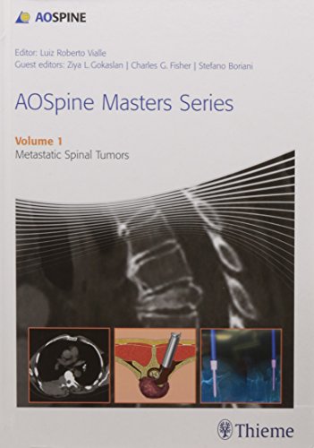 technical/general/aospine-masters-series-volume-1-metastatic-spinal-tumors-1-e-9789385062162